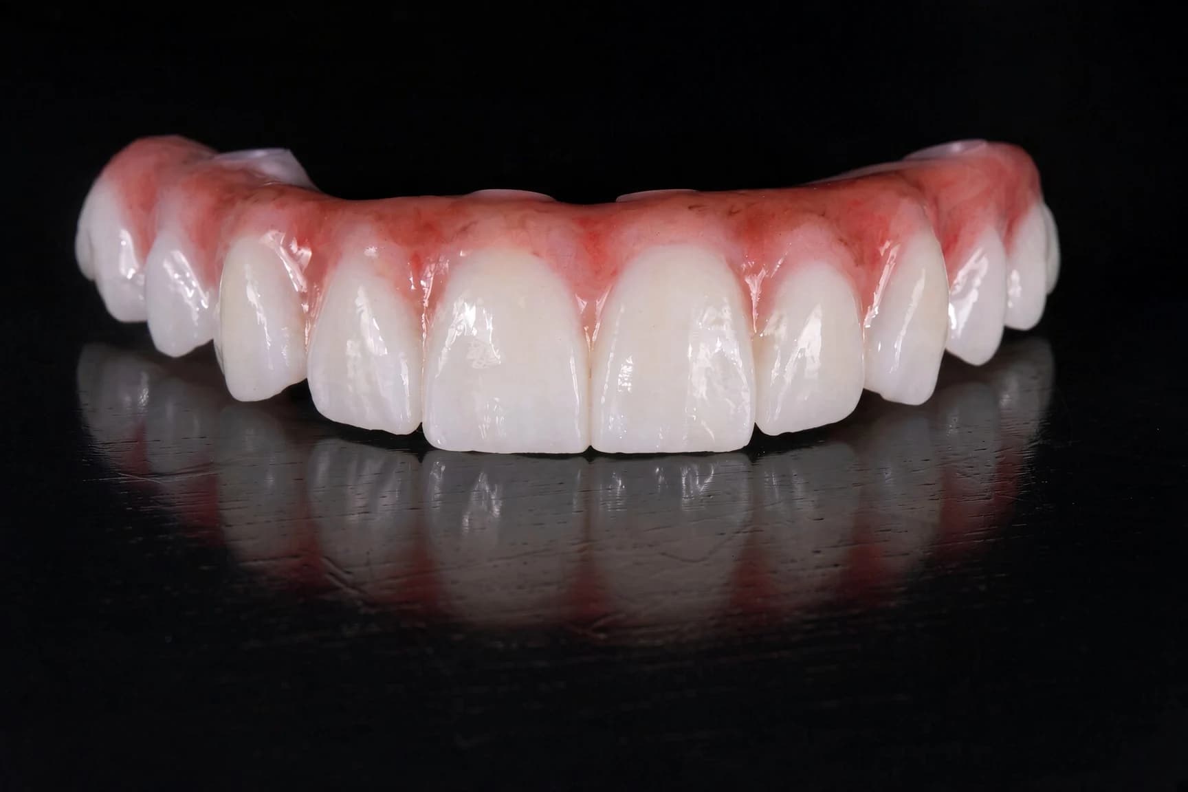Upper full-arch implant restoration with pink gums and a complete row of prosthetic teeth on a black studio background